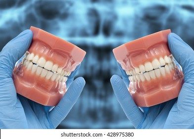 Dentist Hand Show Dental Mold Smiling