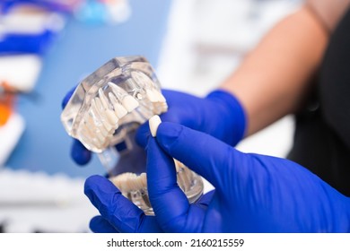 Dentist Holding An Artificial Lower Jaw. Dental Prosthesis. Tooth Plate. Prosthetics Work