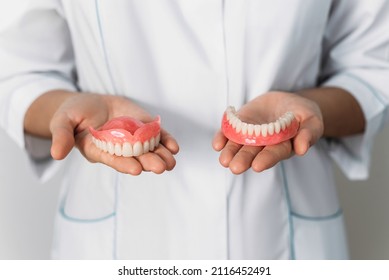 The dentist is holding dentures in his hands. Dental prosthesis in the hands of the doctor close-up. Front view of complete denture. Dentistry conceptual photo. Prosthetic dentistry. False teeth - Shutterstock ID 2116452491