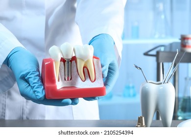Dentist holding educational model of gum with dental implant between teeth indoors, closeup