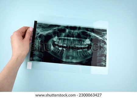 A dentist holding snapshot the patient's tooth. Panoramic shot of the jaw on a light blue background.