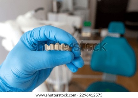 The dentist holds a ceramic, zirconium, bridge-shaped, non-removable dental prosthesis in his hand. Dental bridge.