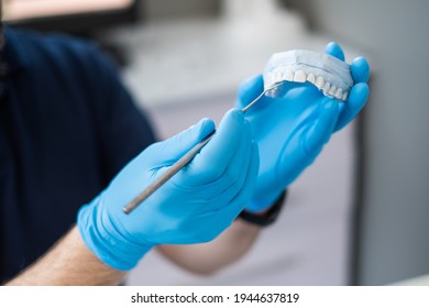 The Dentist Holds A Plaster Cast Of The Jaw. Blue Gloves.