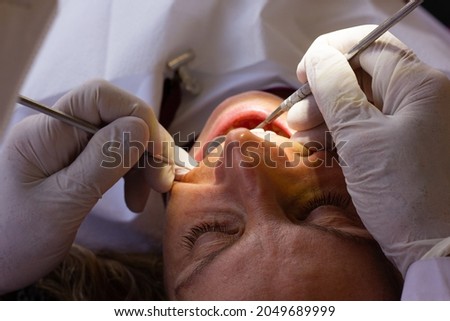 Dentist with latex gloves using orthodontic instruments checking teeth of female patient with mouth open. Oral care, dental clinic treatment concepts