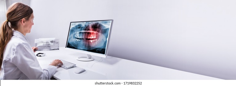 Dentist Looking At Teeth Xray Scan On Computer