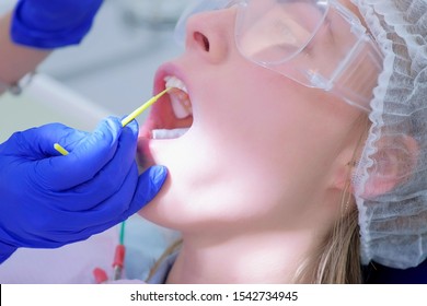 Dentist make fluoridation of teeth after ultrasonic cleaning for young woman. Stomatologist apply fluoride on patient's teeth. Portrait of young woman. Stomatology clinic, cure, treatment, procedure.