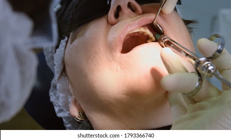 Dentist making local anaesthesia shot before surgery. Senior woman at dental clinic. Dentist with assistant install implant in a patient mouth in modern dental office