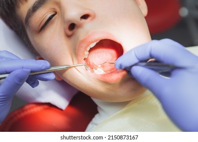 The Dentist In The Office Treats The Teeth Of The Patient, Who Is In The Dental Chair. . Dentist Puts A Dental Filling