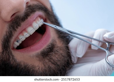 Dentist performing examination with specialized tools during routine dental checkup - Powered by Shutterstock