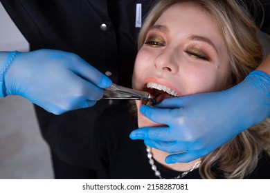 The dentist performs tooth extraction with tongs in a young girl patient on a light background - Shutterstock ID 2158287081