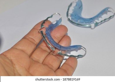 Dentist versorgt den Patienten mit einem kieferorthopädischen Verschluss. Nahaufnahme von Zahnhaltern aus blauem Acryl .