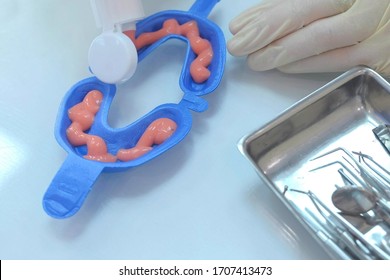 Dentist is putting fluoride gel in mouth guard in stomatology clinic, hands closeup. Procedure for fluoridation of teeth in dentistry. Stomatologist hygienists preparing materials to treatment.