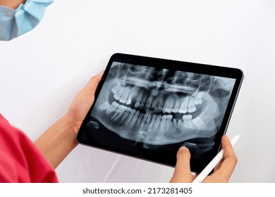 
Dentist Reviewing The X-ray On An Ipad To Indicate To The Patient His Dental Treatment. Woman Dentist Holding A Tablet