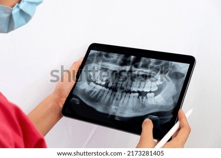 
Dentist reviewing the x-ray on an ipad to indicate to the patient his dental treatment. Woman dentist holding a tablet