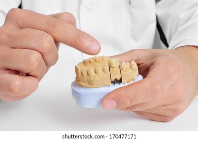 A Dentist Showing Pointing A Prosthesis In A Dental Mould