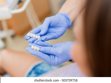 Dentist Showing Porcelain Crowns To The Patient. Close-up. Selective Focus. Focus On Crowns. 