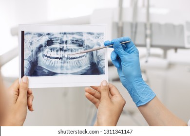 Dentist showing X-ray image to patient. People, medicine, stomatology, technology and health care concept - happy female dentist with teeth x-ray image and patient woman at dental clinic office. No
