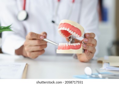 Dentist shows problem areas in teeth on artificial jaw closeup - Shutterstock ID 2058717551