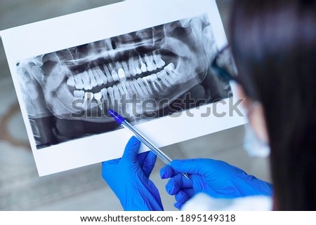 Dentist shows an X-ray of jaw with an implanted tooth . Dentist services concept