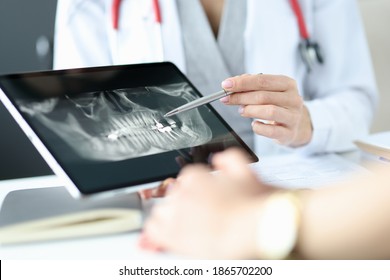 Dentist shows an X-ray of jaw to patient on tablet. Dentist services concept - Powered by Shutterstock