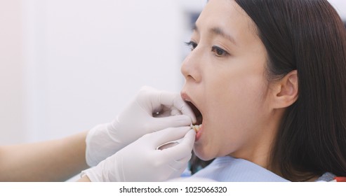 Dentist teaching patient how to use dental floss 