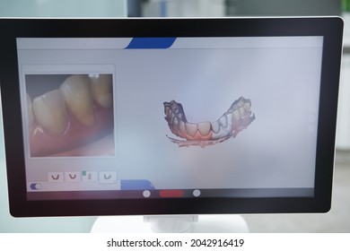 Dentist Using Intraoral Scanner At Work