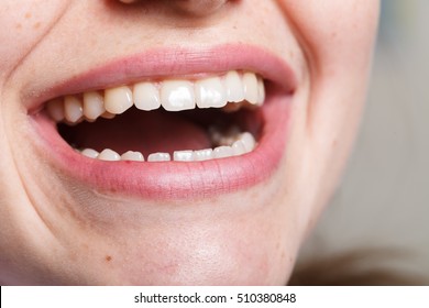 Dentistry, Dental , Mouth And Teeth Close Up Smiling