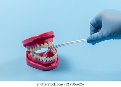 Dentist's Hand In A Latex Glove With The Saliva Ejector And The Human Jaw Layout On The Blue Background. Medical Tools Concept.