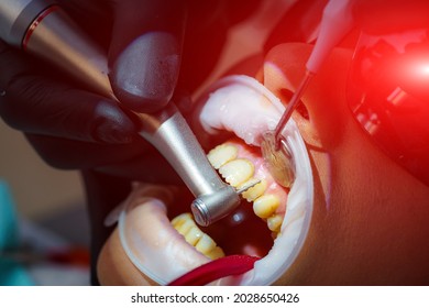 Dentists Very Carefully Check Up And Repair Tooth Of Young Female Patient In Safety Glasses. Medicine And Dentistry Concept