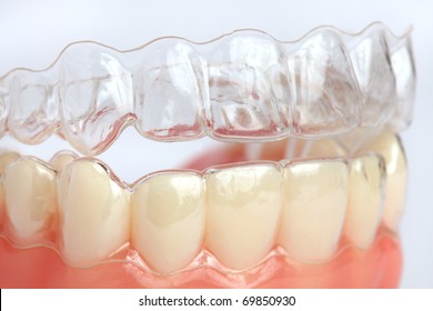 Denture with braces