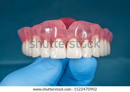 denture. Full removable denture of the upper jaw of man with white beautiful teeth in the hand of a dentist. Aesthetic Dentistry