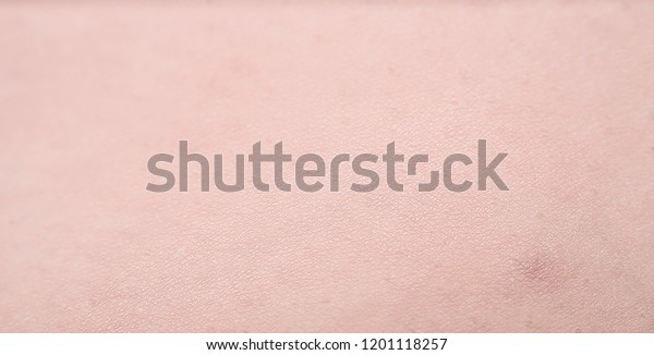 Depilation Sugaring Hair Removal Follicle Woman Stock Photo Edit