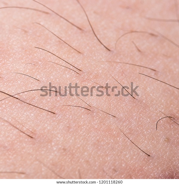 Depilation Sugaring Hair Removal Follicle Woman Stock Photo Edit