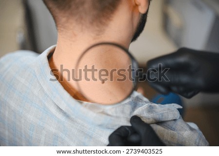 Dermatologist checking a potentially dangerous mole on a patient's neck with a magnifying glass for skin health