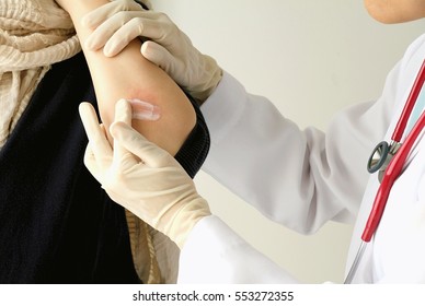 Dermatologist Doctor Doing Treatment, Female Patient With Allergic Rash Dermatitis Eczema Skin, Skin Diseases.