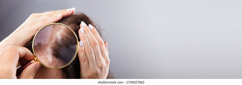 Dermatologist Doctor Examining Woman Hairfall And Hairloss