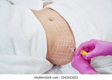 Dermatologist is doing injection into the subcutaneous fat in aesthetic clinic - Shutterstock ID 2161411821