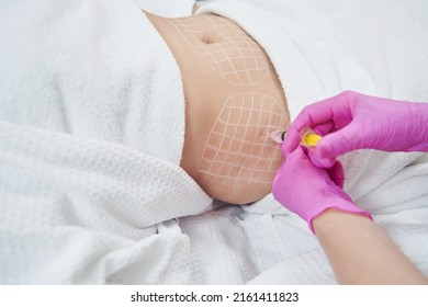 Dermatologist is doing injection into the subcutaneous fat in aesthetic clinic