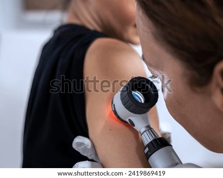 dermatologist examines birthmarks on the patient's skin with a dermatoscope. Dermatology, skin mole examining. looking for signs of melonoma or skin cancer.