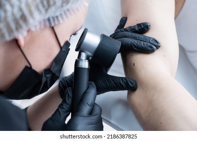 A dermatologist examines a patient's mole through a dermatoscope. 