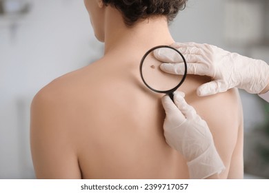 Dermatologist examining mole on young man's back with magnifier in clinic, closeup - Powered by Shutterstock