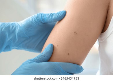 Dermatologist examining moles on young woman in clinic, closeup - Powered by Shutterstock