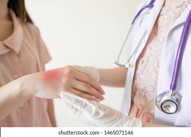 Dermatologist examining patient hand w/ redness rash skin at hospital. Cause of itchy skin include dermatitis (eczema), psoriasis, dry skin, burned or food/drugs allergies. Treatment of skin disease.
