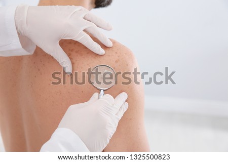 Dermatologist examining patient's birthmark with magnifying glass in clinic, closeup. Space for text