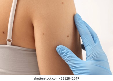 Dermatologist examining patient's birthmark on beige background, closeup - Powered by Shutterstock