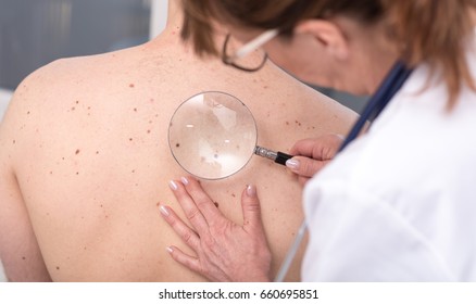 Dermatologist Examining The Skin On The Back Of A Patient