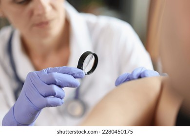 Dermatologist with gloves and magnifying glass examines patient skin in clinic closeup. Doctor checkups derma condition at appointment - Powered by Shutterstock