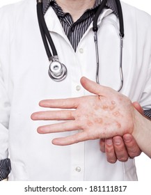 Dermatologist Holding A Woman's Hand And Diagnosing A Severe Case Of Eczema Or Dermatitis