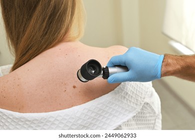 A dermatologist oncologist uses a dermatoscope to examine moles and birthmarks on the patient's body. Melanoma Day, Skin Cancer - Powered by Shutterstock