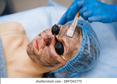 Dermatologist Smears Black Mask On Face For Laser Photorejuvenation And Carbon Peeling. Dermatology And Cosmetology. Using Surgical Laser.